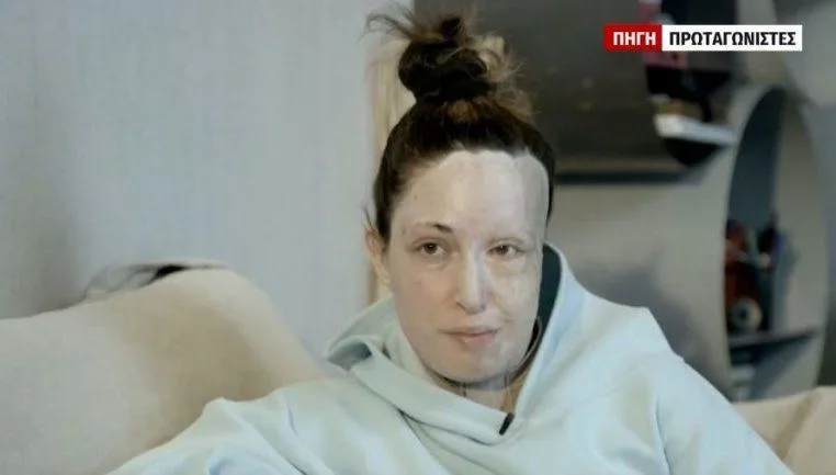 paliospyrou xoris maska