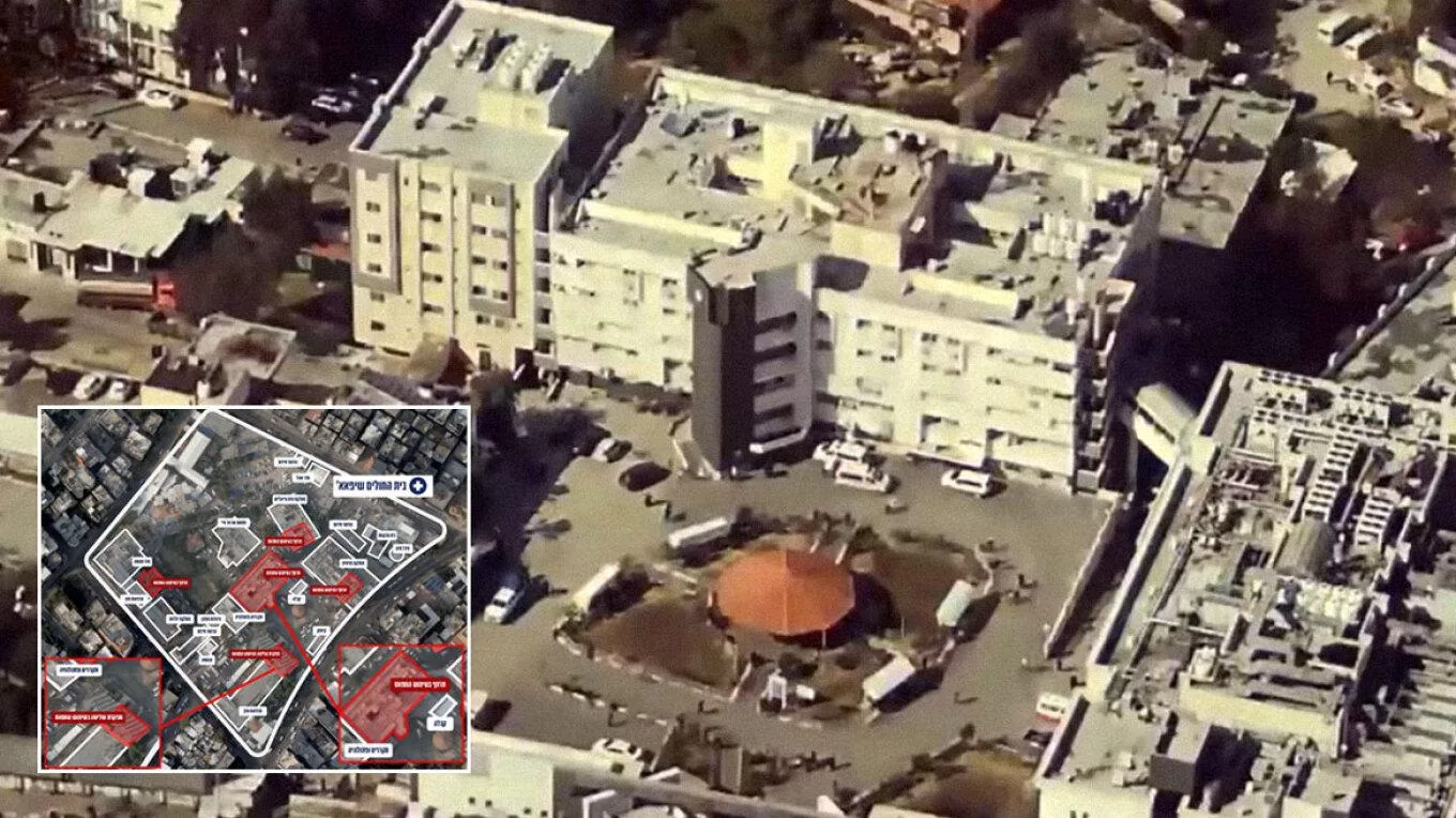 shifa-hospital-arthrou.jpg